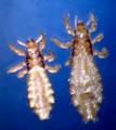 headlice